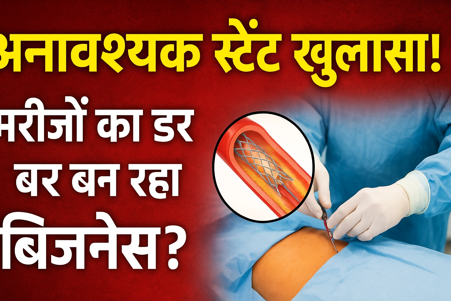 INDIA में अनावश्यक स्टेंट ऑपरेशन का खुलासा: मरीजों का भरोसा टूटा, हेल्थकेयर सिस्टम पर उठे बड़े सवाल